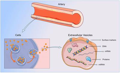 Role of Extracellular Vesicles as Potential Diagnostic and/or Therapeutic Biomarkers in Chronic Cardiovascular Diseases